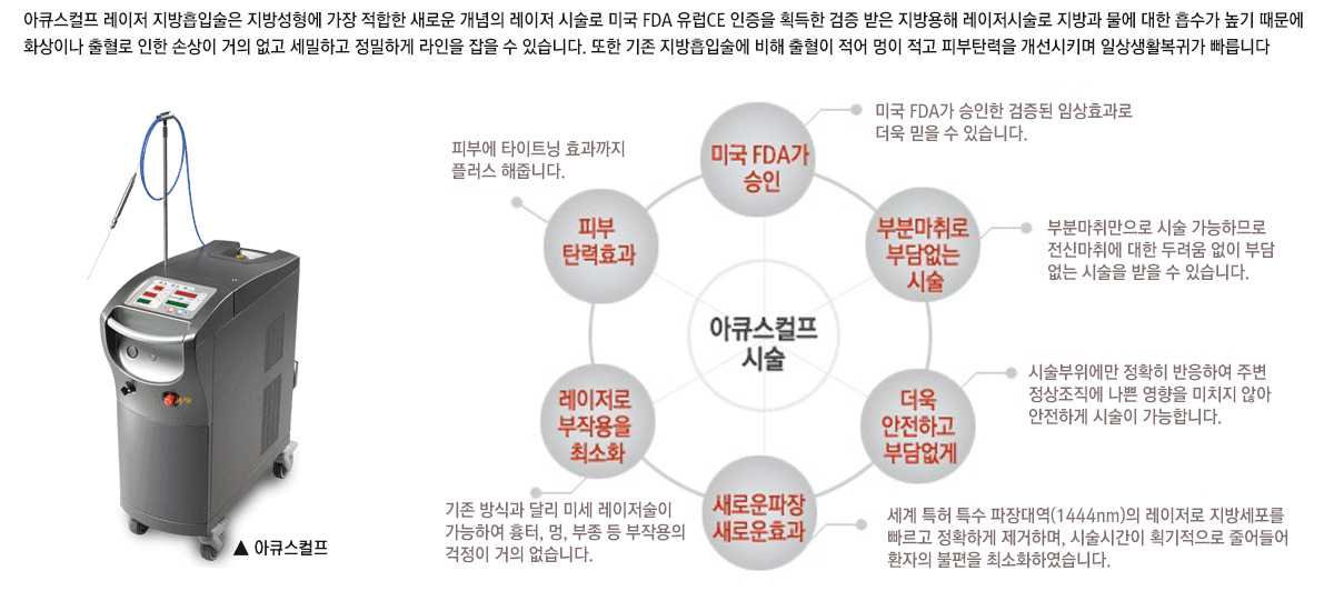 아큐스컬프 레이저 지방흡입술